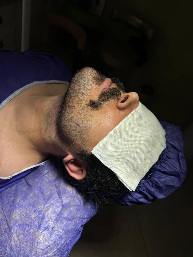 نتیجه ساکشن غبغب در کلینیک زیبایی عصر رویایی تهران– مشاغل ممتاز