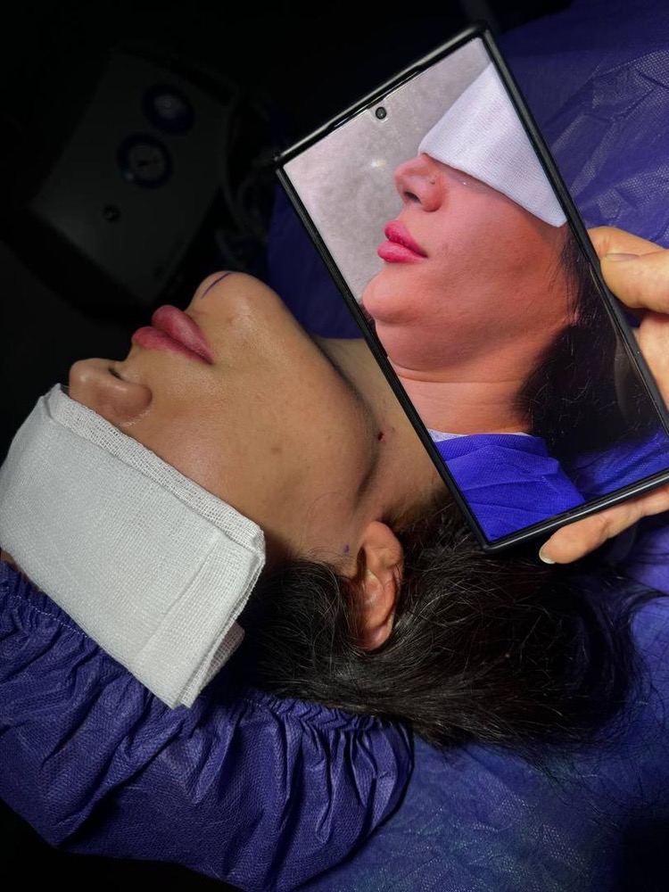 خدمات ساکشن غبغب در کلینیک زیبایی عصر رویایی تهران با تکنیک تخصصی و ایمن – مشاغل ممتاز