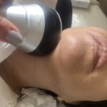 لاغری موضعی بانوان غزاله نوروزی همدان