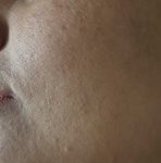 لاغری موضعی بانوان غزاله نوروزی همدان