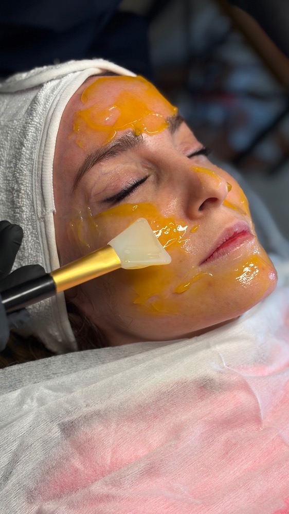 فیشال و پاکسازی عمیق پوست با مواد تخصصی در کلینیک عصر رویایی تهران – مشاغل ممتاز
