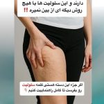 لاغری موضعی بانوان غزاله نوروزی همدان
