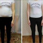 لاغری موضعی بانوان غزاله نوروزی همدان