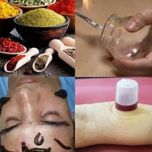 حجامت درمانی صفری تهران-مشاغل ممتاز