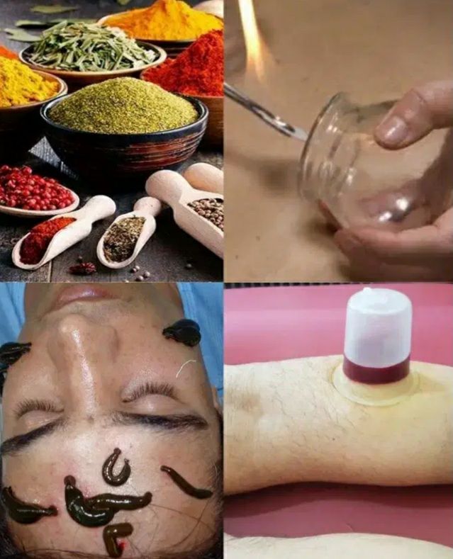 خدمات حجامت درمانی صفری تهران
