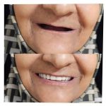 ساخت دندان متحرک رضایی یزد