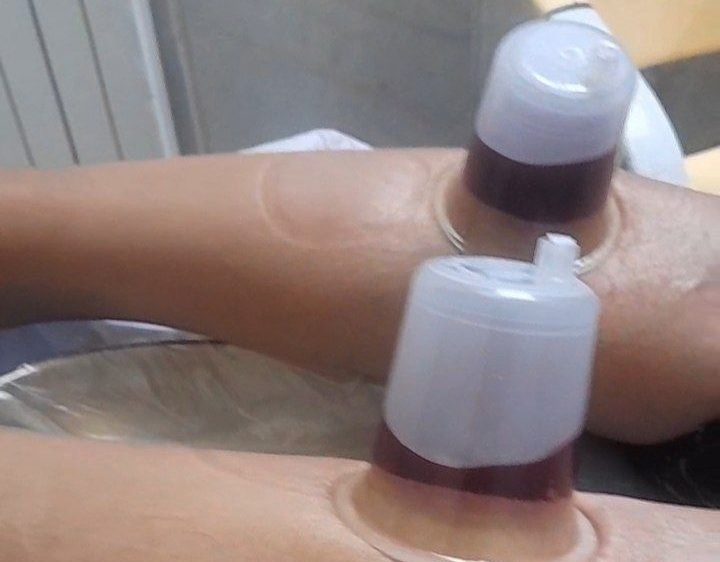 بادکش تخصصی طب سنتی شفا زابل – مشاغل ممتاز
