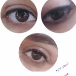 ریمو تاتو زهرا انصاری اصفهان