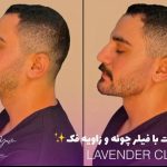 کلینیک زیبایی کاشت مو و ابرو لوندر در ساری