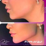 کلینیک زیبایی کاشت مو و ابرو لوندر در ساری