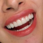 دندانپزشکی دکتر سمیرا رمضانی در ملارد