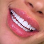 دندانپزشکی دکتر سمیرا رمضانی در ملارد