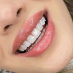 دندانپزشکی دکتر سمیرا رمضانی در ملارد