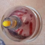 طب سنتی مهین قلی زاده در یاسوج