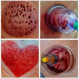 طب سنتی مهین قلی زاده در یاسوج-مشاغل ممتاز
