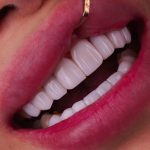 دندانپزشکی دکتر سمیرا رمضانی در ملارد