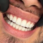 دندانپزشکی دکتر سمیرا رمضانی در ملارد