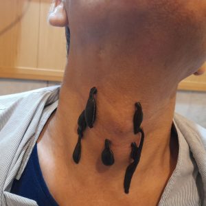 زالو درمانی طب سنتی شفا زابل – مشاغل ممتاز