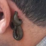 حجامت طب سنتی شفا زابل