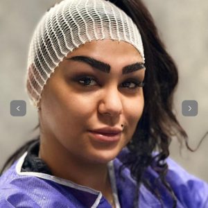 کلینیک کاشت مو و ابرو محرمی تبریز-مشاغل ممتاز