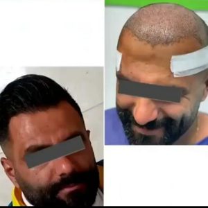 مرکز کاشت مو و ابرو پگاه ولیعصر تبریز-مشاغل ممتاز