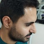 مرکز کاشت مو و ابرو پگاه ولیعصر تبریز