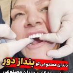 دندانپزشکی زیبا صادقیه تهران