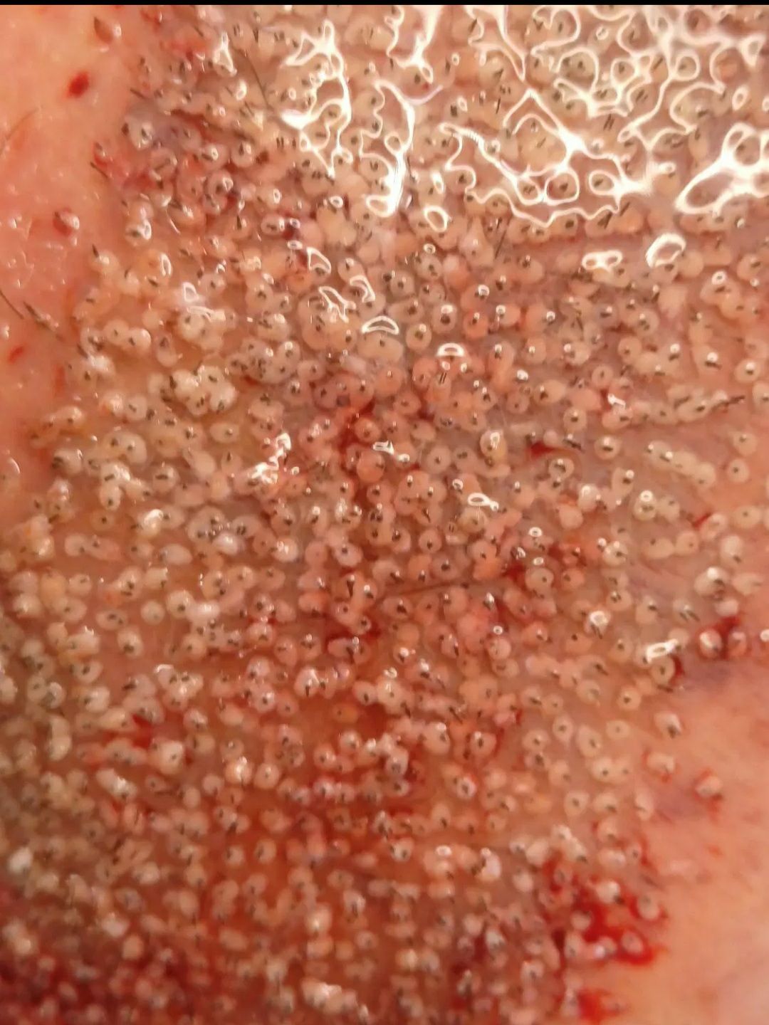 کاشت مو و ابرو رویال تبریز-مشاغل ممتاز