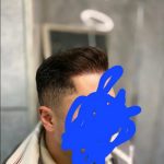 مرکز کاشت مو و ابرو رویال تبریز