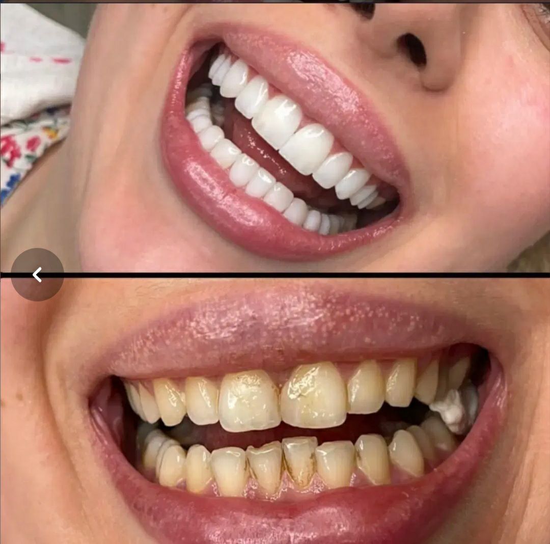 مطب دکتر سمیرا رمضانی در ملارد ارائه دهنده خدمات حرفه‌ای دندانپزشکی-مشاغل ممتاز 