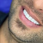 دندانپزشکی دکتر سمیرا رمضانی در ملارد