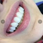 دندانپزشکی دکتر سمیرا رمضانی در ملارد
