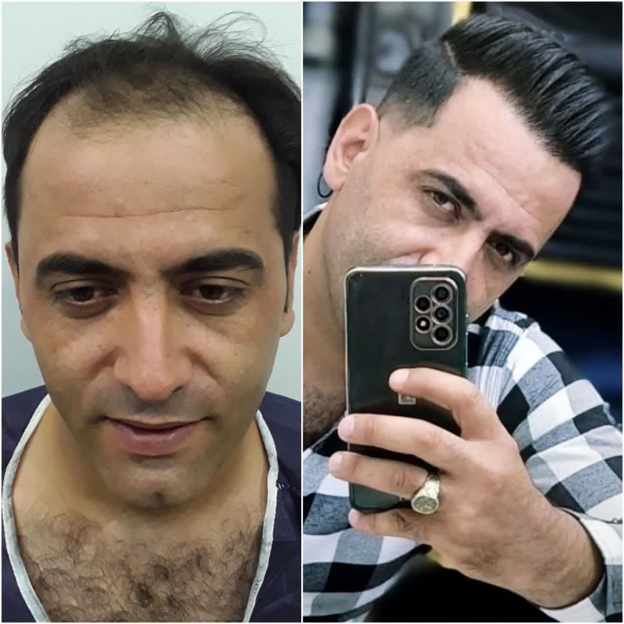 مرکز تخصصی پوست و مو در قم | ترکیب درمان و زیبایی برای نتیجه طبیعی و ماندگار-مشاغل ممتاز