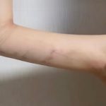 مطب زیبایی دکتر امین صبوری فرد در مشهد
