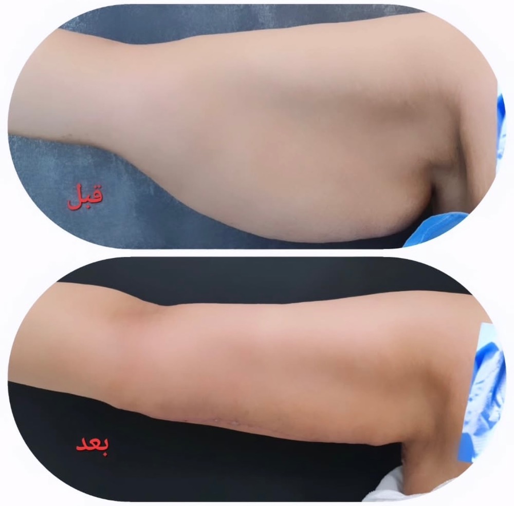 حذف چربی مطب زیبایی دکتر امین صبوری فرد در مشهد-مشاغل ممتاز
