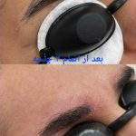 ریمو تاتو زهرا انصاری اصفهان