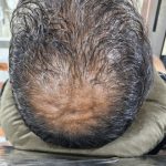 خدمات پاکسازی و جوانسازی پوست ناهید حکمی مشهد