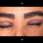 مطب زیبایی دکتر امین صبوری فرد در مشهد