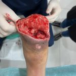 کلینیک تخصصی درمان زخم دکتر ناصری در رشت