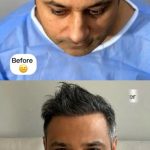 کلینیک کاشت مو آرزو نصیری شیراز
