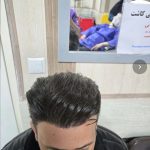 مرکز کاشت مو و ابرو رویال هیر اردبیل