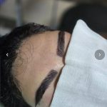 مرکز کاشت مو و ابرو رویال هیر اردبیل