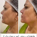 خدمات هایفو حسینی معالی آباد شیراز