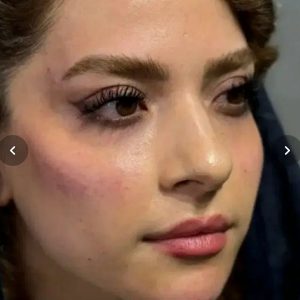 کلینیک زیبایی یلدا قم-مشاغل ممتاز