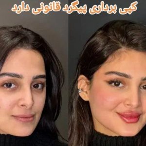 کلینیک زیبایی رز تبریز-مشاغل ممتاز