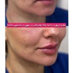 کلینیک زیبایی آویژه مشهد