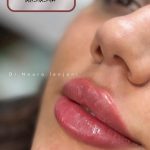 کلینیک زیبایی آویژه مشهد