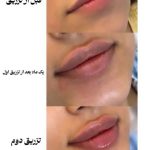 کلینیک زیبایی آویژه مشهد