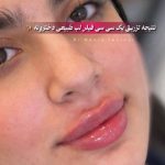 کلینیک زیبایی آویژه مشهد