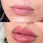 کلینیک زیبایی پایدار در تبریز